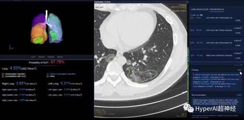 汇医慧影产品被黑客倒卖 官方回应 不涉及源码和客户数据